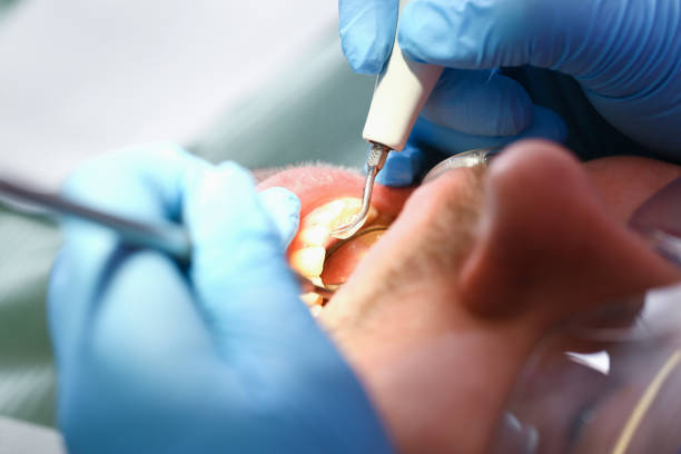 Best Chipped Tooth Repair Near Me  in Willoughby, OH